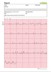 Bild von HeartMate EKG Monitor