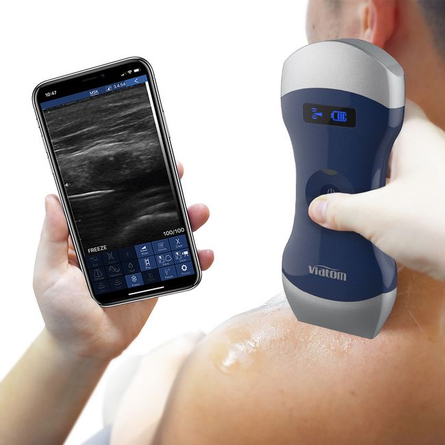 Ultraschallgerät portabel / Sonographiegerät - mobiles Sonogerät / Sonostar  Uprobe-C 4PL, Viatom Eagleview-Healthcare