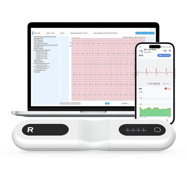 Bild von Langzeit EKG-Monitor Viatom/Wellue ER1-LW 24 Stunden inkl. Datenauswertung via KI-Algorithmus