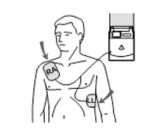 Bild für Kategorie Defibrillatoren / AED's